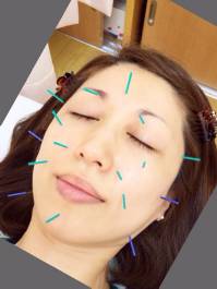 美容 hiromi 美容 hiromi